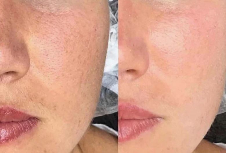 Before & After